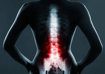 Age Limit for Spinal Surgery