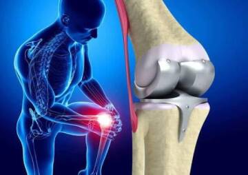 What Do You Know About Knee Replacement Surgery Risks?
