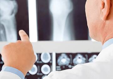 what Orthopedic doctors do?
