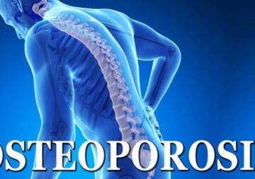 Знайте типы остеопороза, чтобы иметь менее болезненное старение