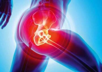 What Is The Average Age For Hip Replacement?