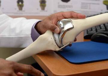 How Long Does a Knee Replacement Last?