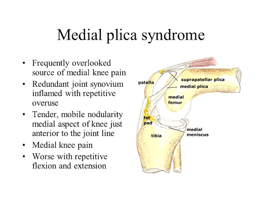 Knee Anatomy Plica